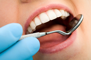 professional teeth cleaning