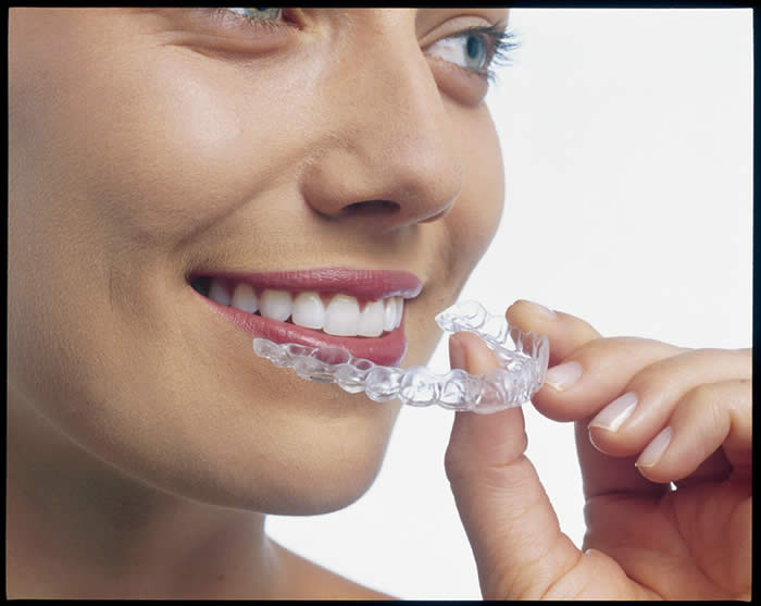 invisalign