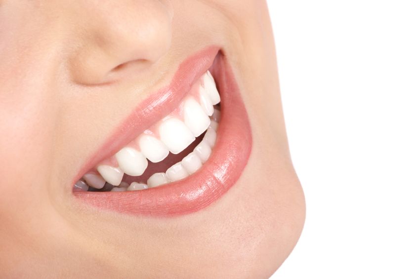 porcelain veneers