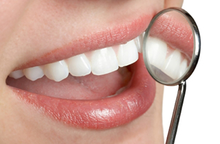 Dental Crowns in Ocala